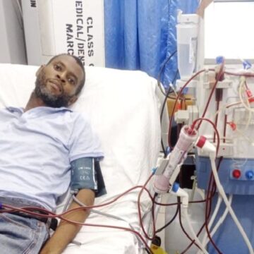 Public servant seeks N34m for kidney transplant