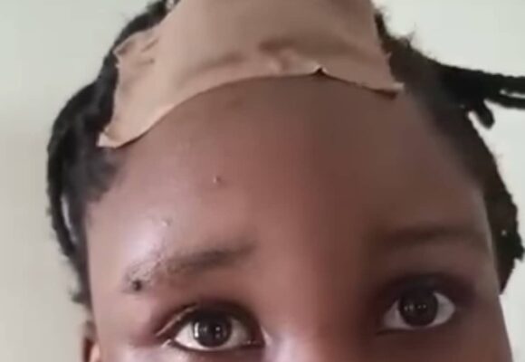 Edo sales rep battered in sexual dispute with boss